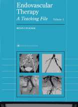 Endovascular Therapy - A Teaching File