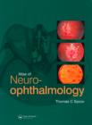 An Atlas of Neuro-ophthalmology