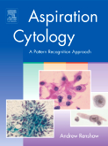 Aspiration Cytology - A Pattern Recognition Approach