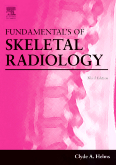 Grainger and Allison's Diagnostic Radiology 4/e 3 Volumes
