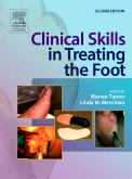 Clinical Skills in Treating the Foot, 2nd Edition