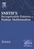 Smith’s Recognizable Patterns of Human Malformation, 6th Edition