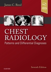 Chest Radiology: Patterns and Differential Diagnoses,  7th Edition 2018