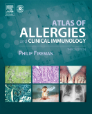 Atlas of Allergies and Clinical Immunology, 3rd Edition - Textbook with CD-ROM