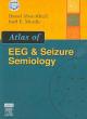 Atlas of EEG & Seizure Semiology - Textbook with DVD