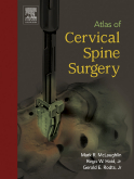 Atlas of Cervical Spine Surgery 2005