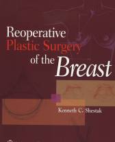 Reoperative Plastic Surgery of the Breast Hardbound