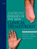 Andrews' Diseases of the Skin, Clinical Dermatology10th Edition