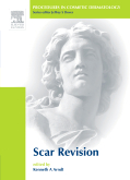 Procedures in Cosmetic Dermatology Series: Scar Revision