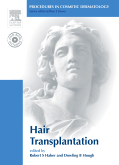 Procedures in Cosmetic Dermatology Series: Hair Transplantation - Textbook with DVD