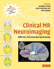 Clinical MR Neuroimaging: Diffusion, Perfusion and Spectroscopy(已缺書,暫不供應)