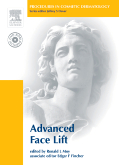 Procedures in Cosmetic Dermatology Series: Advanced Face Lifting - Textbook with DVD