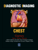 Diagnostic Imaging: Chest