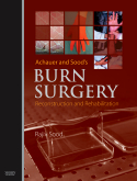 Achauer and Sood's Burn Surgery, Reconstruction and Rehabilitation