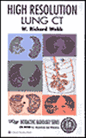 High-Resolution Lung CT CD-ROM for Windows and Macintosh