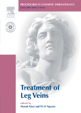 Procedures in Cosmetic Dermatology Series: Treatment of Leg Veins - Textbook with DVD