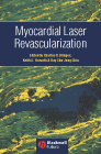 Myocardial Laser Revascularization