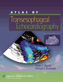 Atlas of Transesophageal Echocardiography Hardbound 2/E