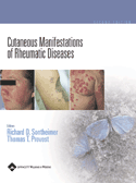 Cutaneous Manifestations of Rheumatic Diseases: Hardbound
