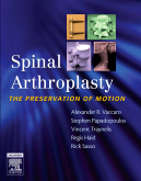 Spinal Arthroplasty with DVD - The Preservation of Motion