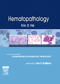 Hematopathology - A Volume in Foundations in Diagnostic Pathology Series