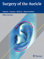 Surgery of the Auricle Tumors-Trauma-Defects-Abnormalities