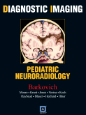 Diagnostic Imaging: Pediatric Neuroradiology