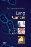 Lung Cancer - Dana-Farber Cancer Institute Handbook