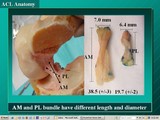 Anatomic Double Bundle ACL Reconstruction: Concepts and Surgical Technique (CD-ROM)