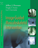 Image-Guided Musculoskeletal Intervention