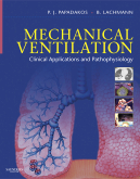Mechanical Ventilation - Clinical Applications and Pathophysiology