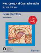 Neuro-Oncology 2/E