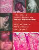 Color Atlas of Vascular Tumors and Vascular Malformations