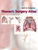 Thoracic Surgery Atlas 2008