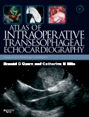 Atlas of Intraoperative Transesophageal Echocardiography - Surgical and Radiologic Correlations, Text with DVD