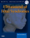 Ultrasound of Fetal Syndromes, 2nd Edition - Text with DVD