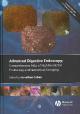 Comprehensive Atlas of High Resolution Endoscopy and Narrowband Imaging (Book with DVD)