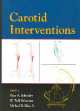 Carotid Interventions