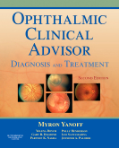 Ophthalmic Clinical Advisor, 2nd Edition - Diagnosis and Treatment