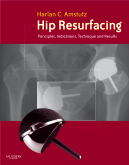 Hip Resurfacing - Principles, Indications, Technique and Results Book and DVD