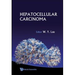 Hepatocellular Carcinoma (Hardcover)