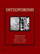 Osteoporosis (2 Volume Set)