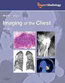 Imaging of the Chest, 2-Volume Set - Expert Radiology Series