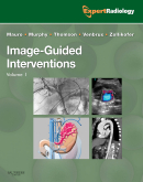 Image-Guided Intervention, 2-Volume Set - Expert Radiology Series(已缺書)