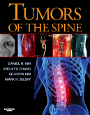 Tumors of the Spine with CD