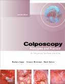 Colposcopy, 2nd Edition - Principles and Practice, Text with DVD