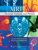 MRI Normal Variants and Pitfalls Hardbound