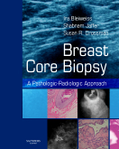 Breast Core Biopsy - A Pathologic-Radiologic Approach