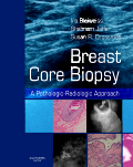 Breast Core Biopsy A Pathologic-Radiologic Approach