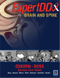 Expert Differential Diagnoses : Brain and Spine Published by Amirsys&reg; Hardbound Book with Companion Online eBook